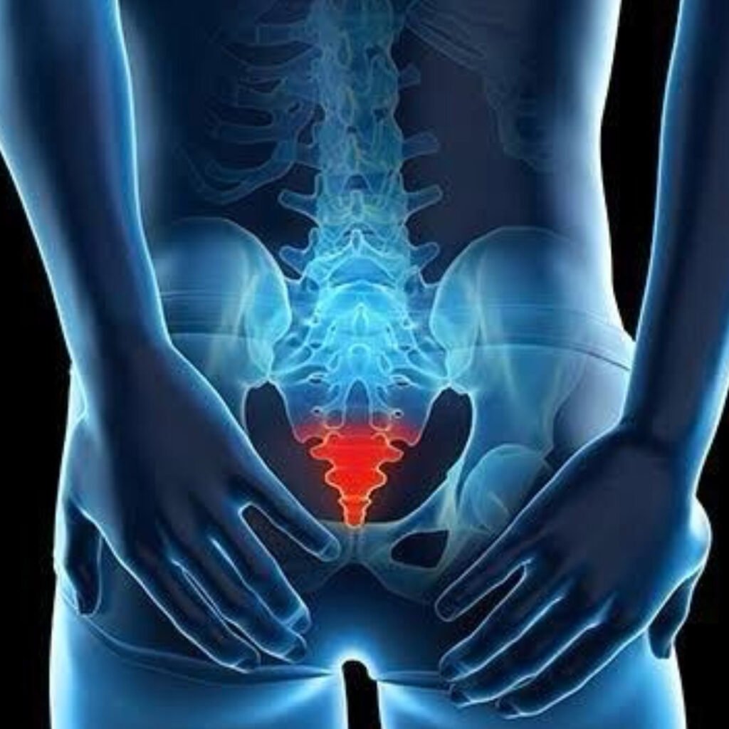 Physiotherapy treatment for Coccydynia focusing on tailbone pain relief, posture correction, and pelvic mobility.