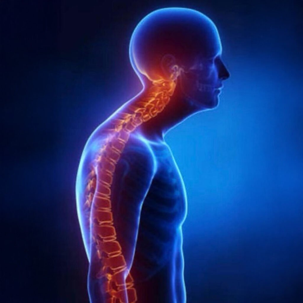 Physiotherapy for Kyphosis focusing on spinal alignment, posture correction, and back muscle strengthening.
