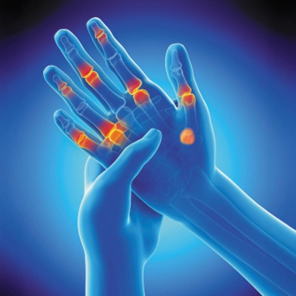 Physiotherapy for Rheumatoid Arthritis focusing on joint pain relief, mobility improvement, and inflammation management.