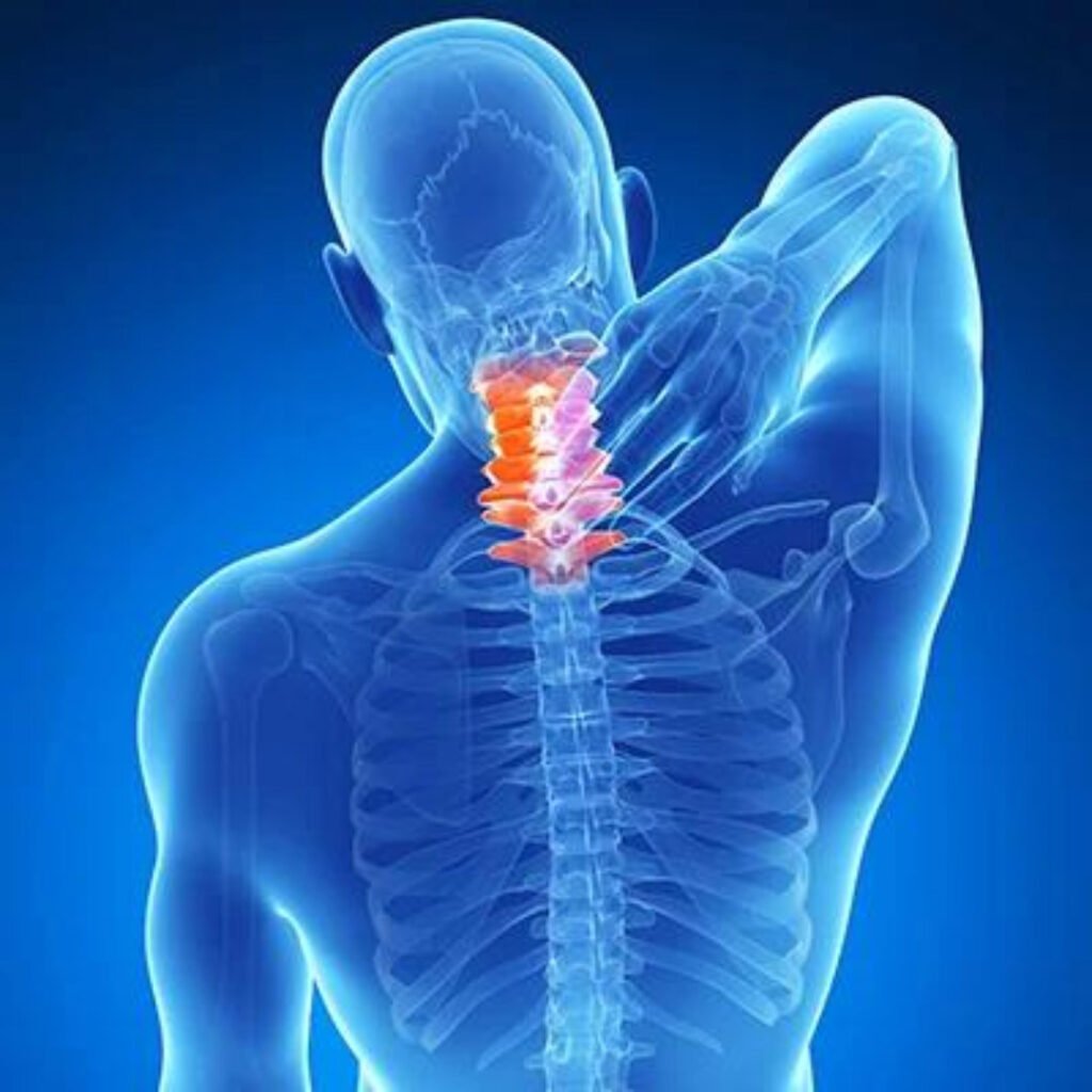 Physiotherapy treatment for Spondylosis focusing on spinal mobility, posture correction, and chronic neck and back pain relief.