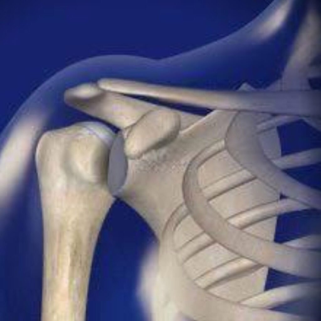 Physiotherapy for joint subluxation focusing on pain relief, stability training, and muscle strengthening.