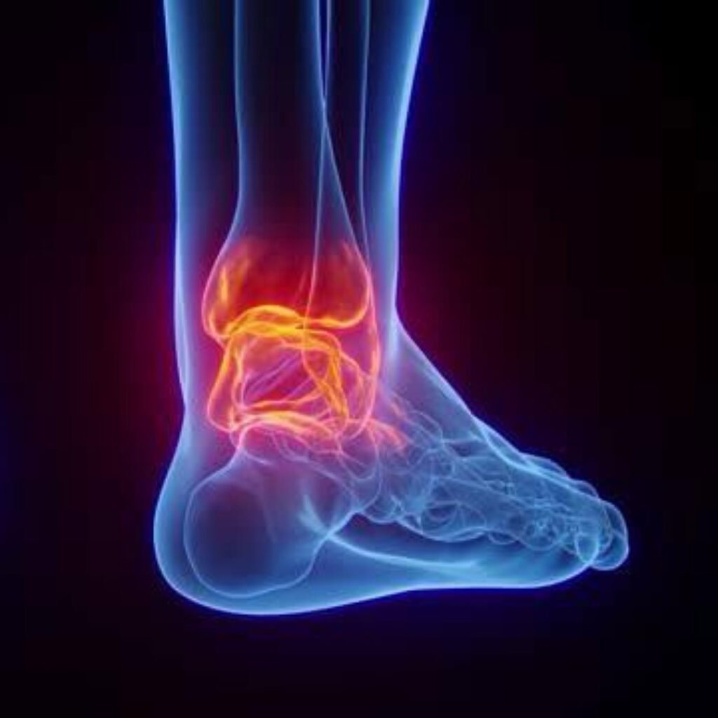 Physiotherapy treatment for Tendinitis focusing on pain relief, inflammation control, and tendon strengthening.