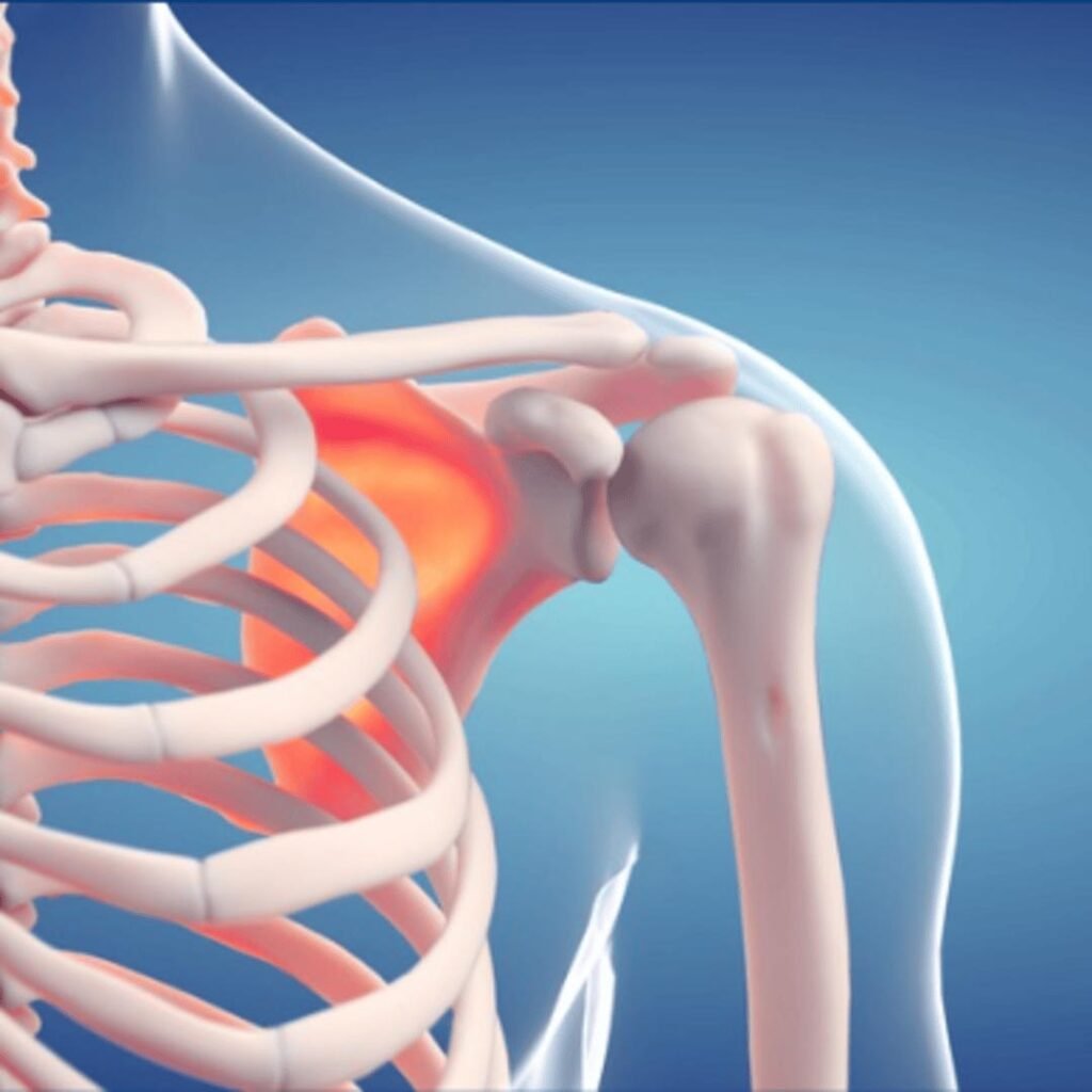 Physiotherapy rehabilitation for bone and soft tissue cancer focusing on strength recovery, mobility improvement, and pain management.