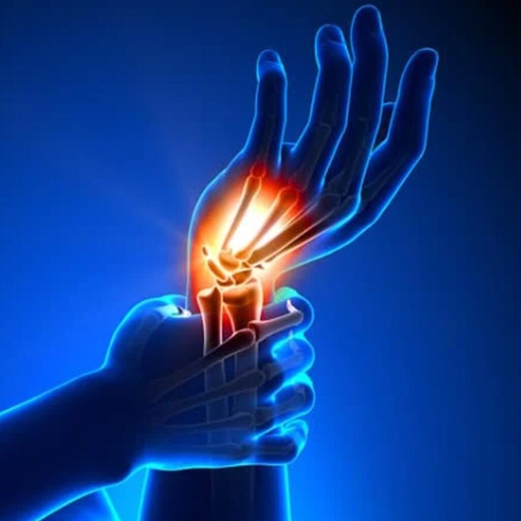 Physiotherapy for Carpal Tunnel Syndrome focusing on wrist pain relief, nerve mobilization, and hand function improvement.