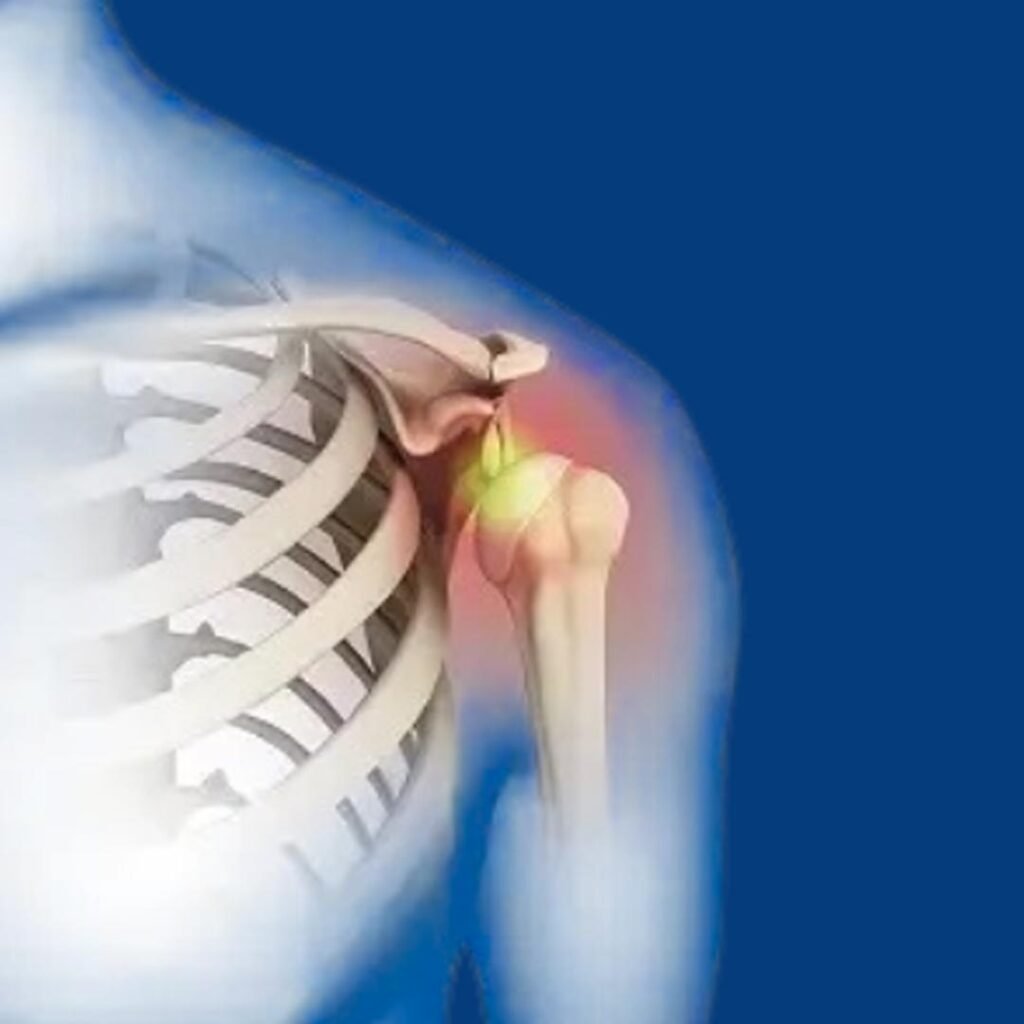 Physiotherapy rehabilitation for joint dislocation focusing on pain control, mobility restoration, and muscle strengthening.