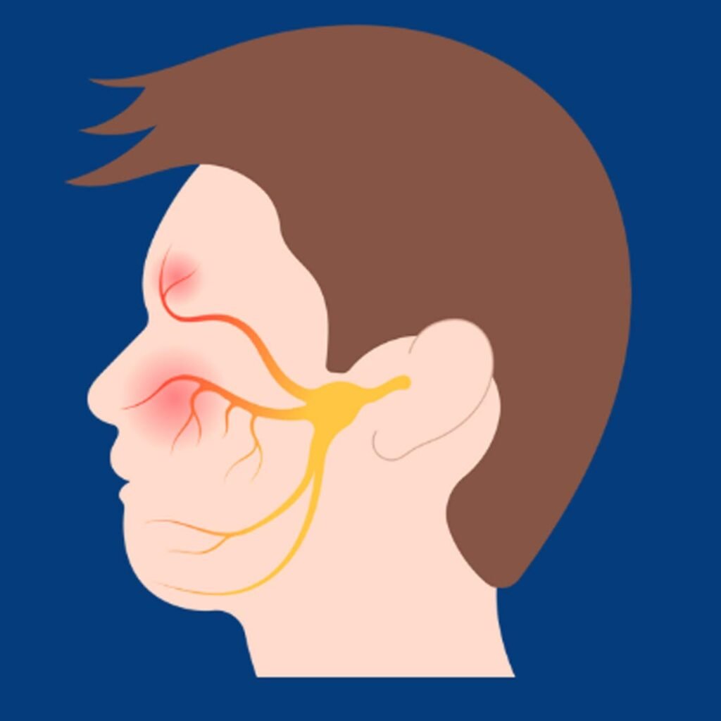 Physiotherapy for Bell’s Palsy focusing on facial muscle stimulation, nerve recovery, and symmetry restoration.