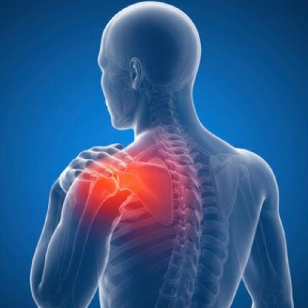 Physiotherapy for Frozen Shoulder focusing on pain relief, shoulder mobility, and joint flexibility improvement.