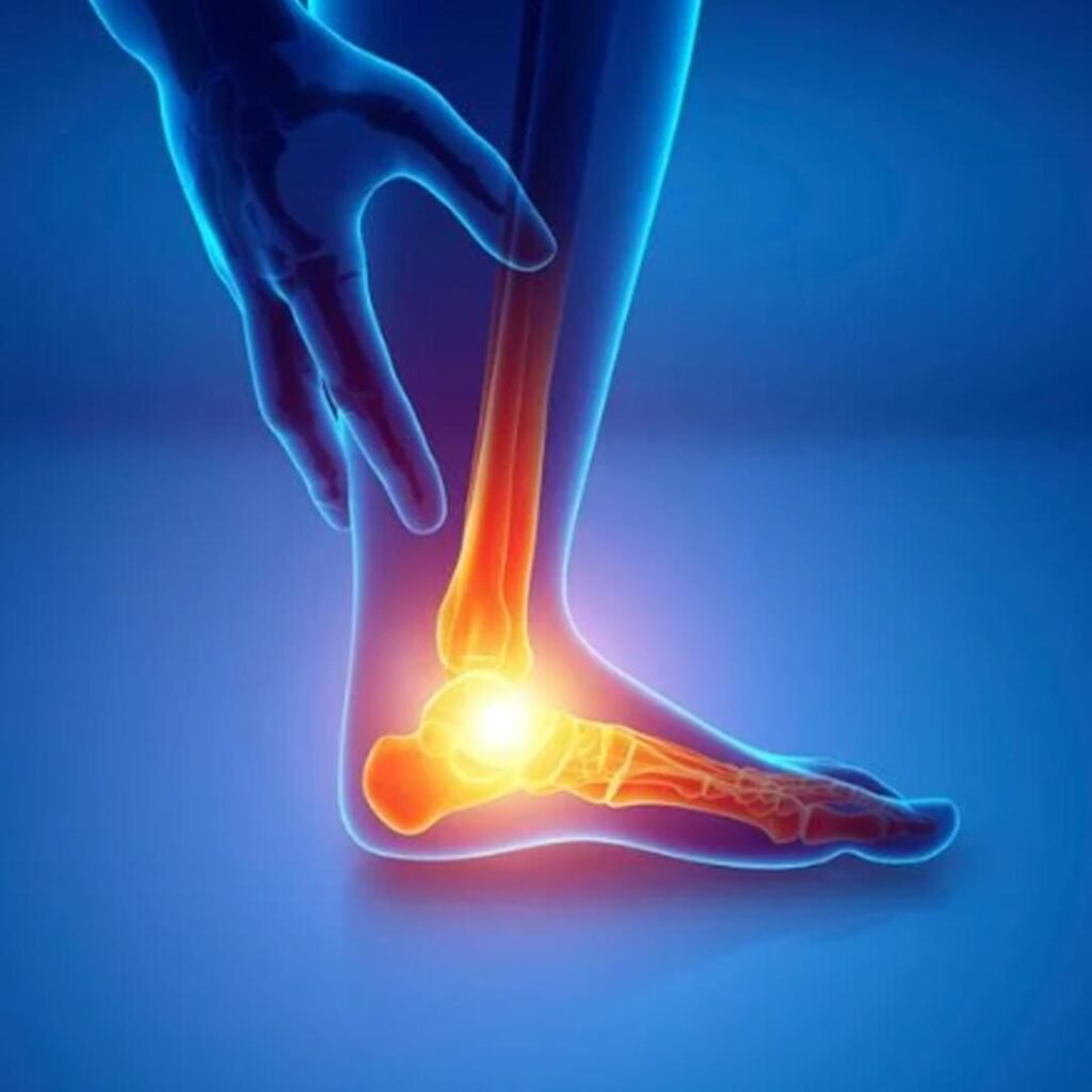 Physiotherapy treatment for Heel Spur focusing on foot pain relief, inflammation control, and improved mobility.