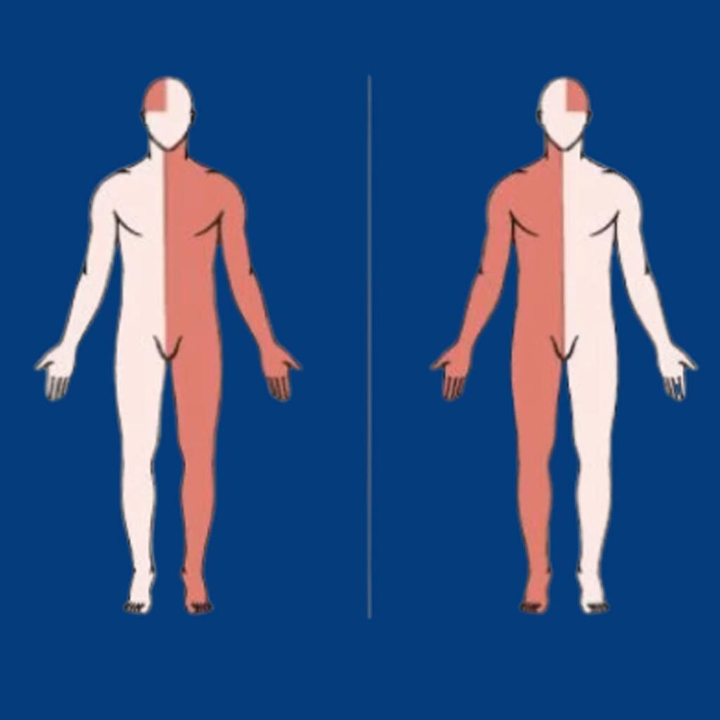 Physiotherapy for Hemiplegia focusing on movement recovery, muscle strengthening, and balance training after stroke.