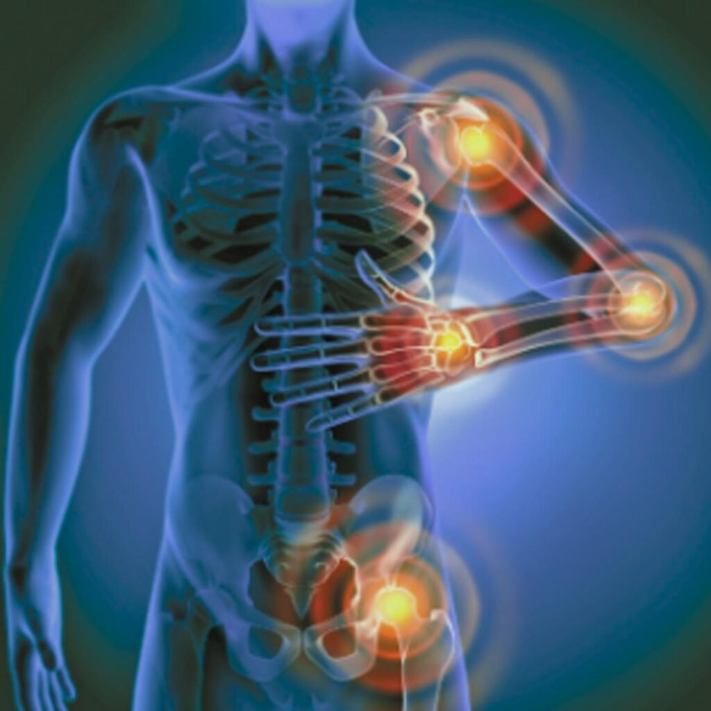 Physiotherapy for inflammatory conditions focusing on pain relief, joint flexibility, and swelling reduction.