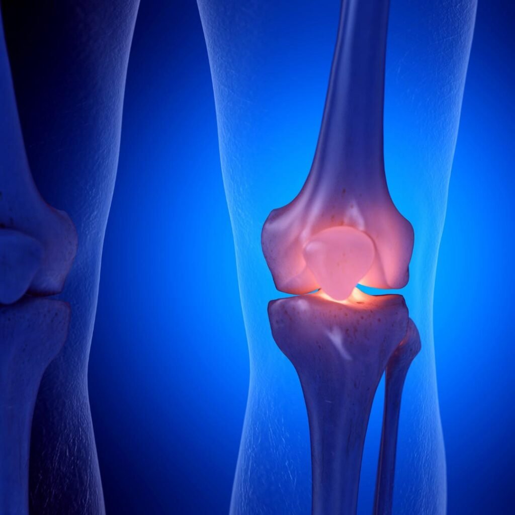 Physiotherapy for Meniscus Tear focusing on knee pain relief, joint stability, and mobility restoration.