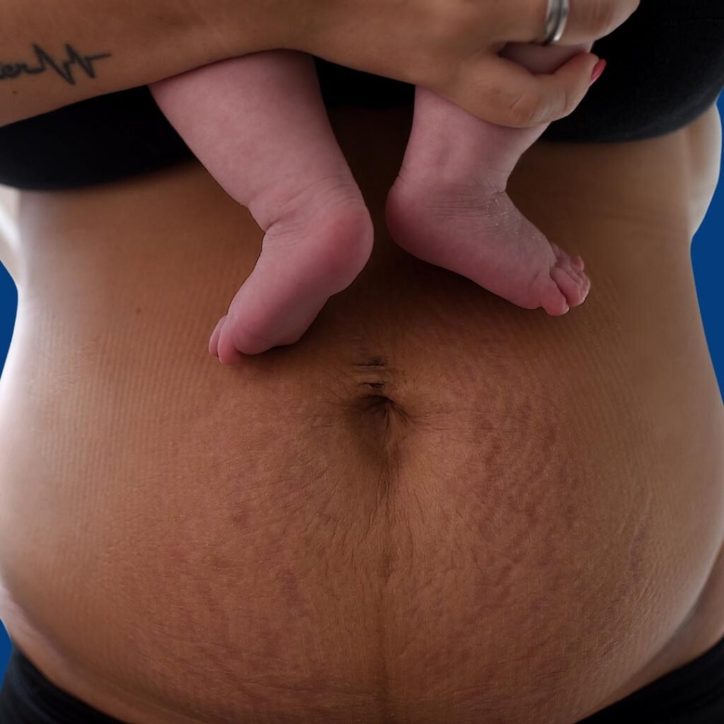 Post-delivery physiotherapy focusing on pelvic floor strengthening, posture correction, and recovery after childbirth.