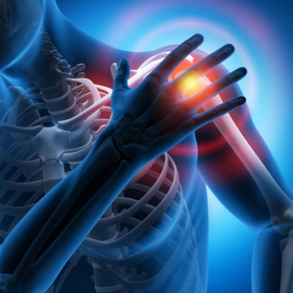 Physiotherapy for muscle strains focusing on pain relief, flexibility restoration, and injury prevention.