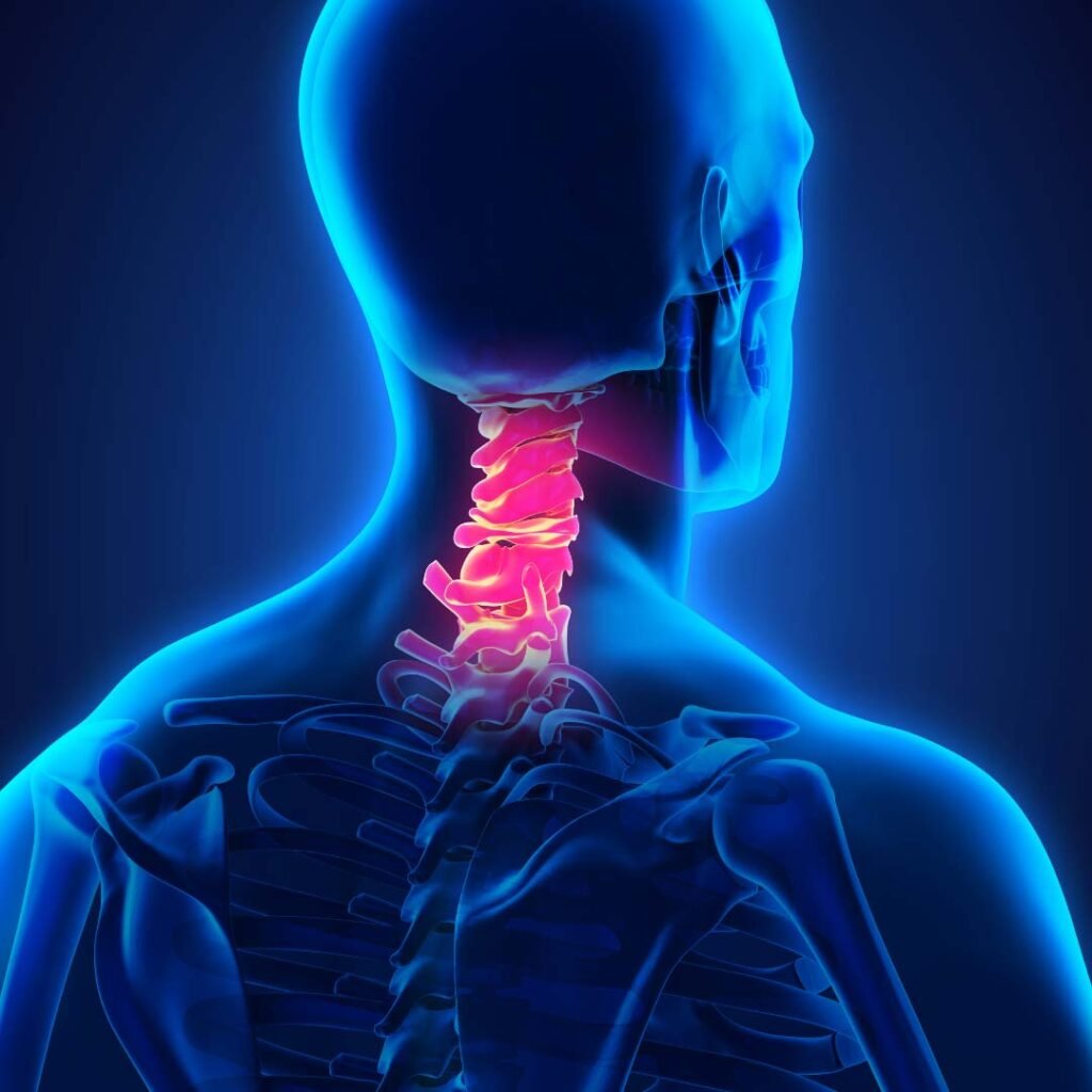Physiotherapy for Cervical Radiculopathy focusing on neck pain relief, nerve decompression, and posture correction.