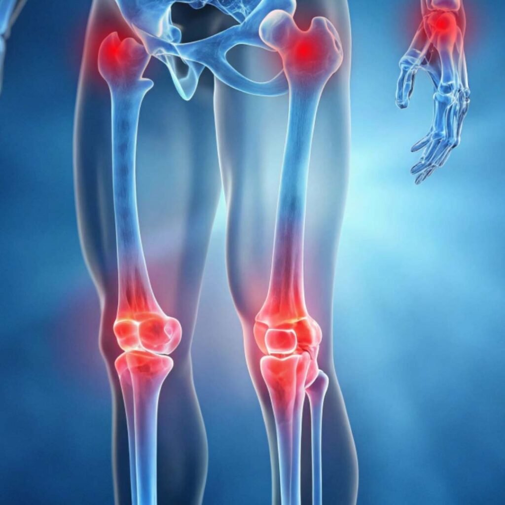 Physiotherapy for Chikungunya recovery focusing on joint pain relief, muscle strengthening, and mobility restoration.