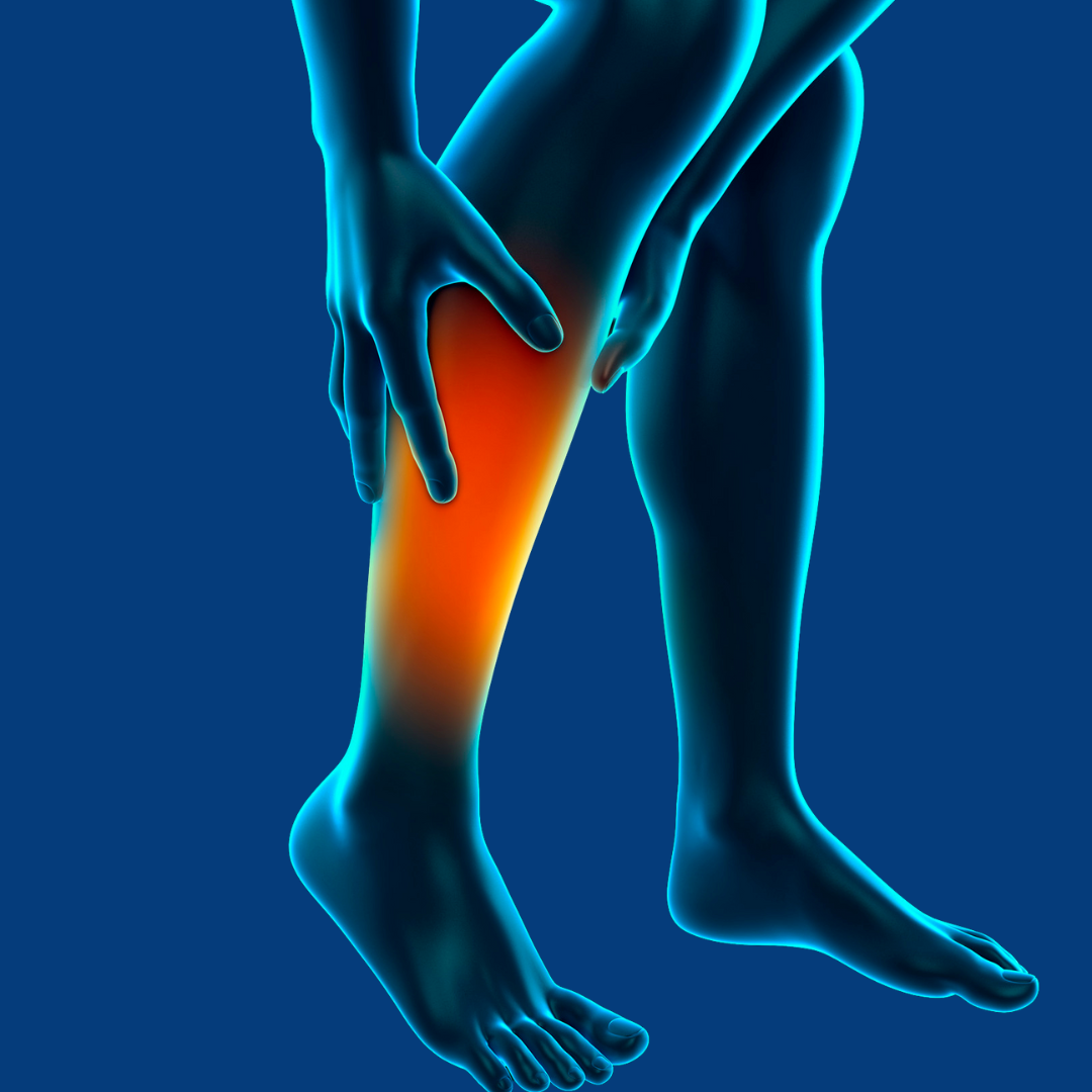Physiotherapy treatment for Shin Splints focusing on pain relief, muscle recovery, and lower leg strengthening.