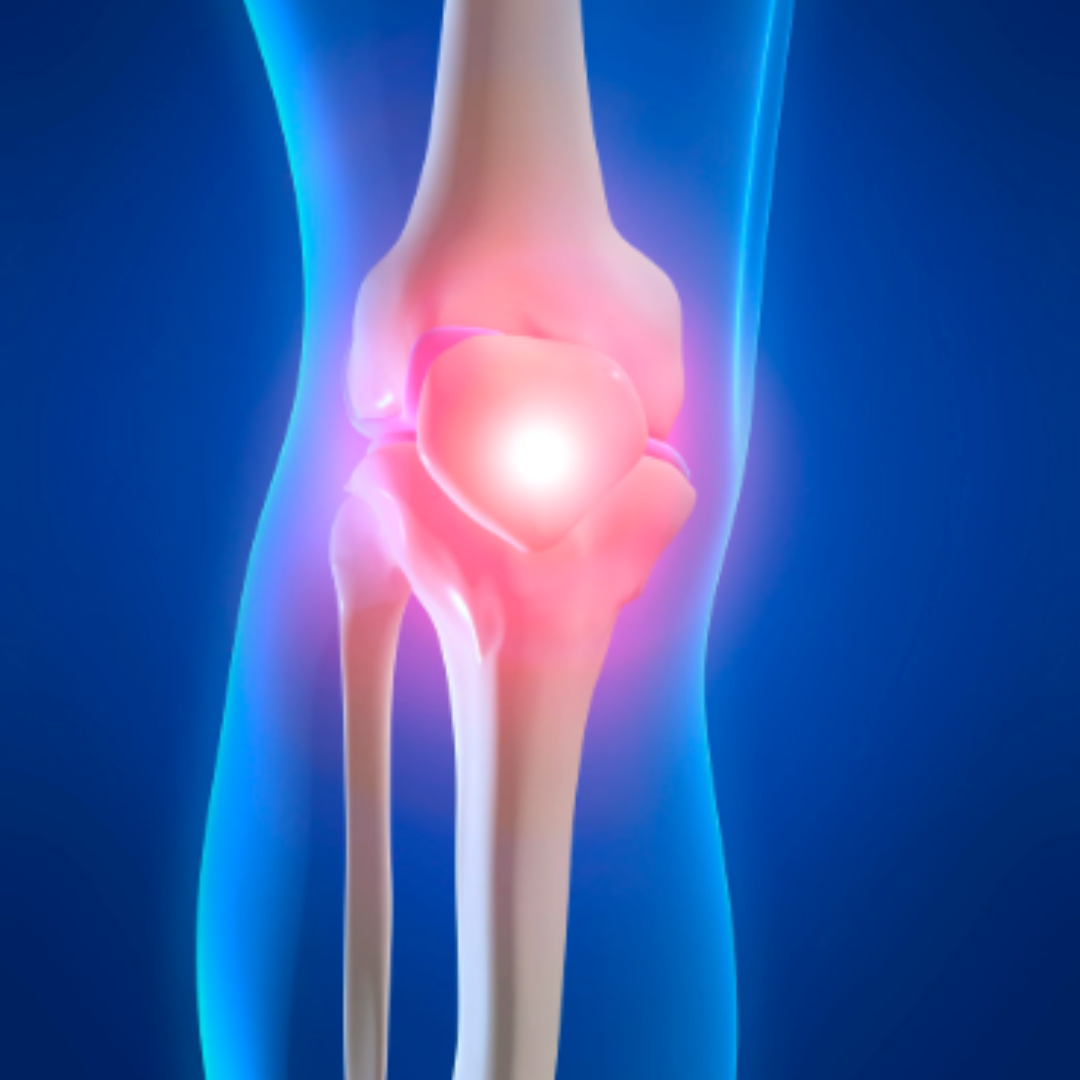 Physiotherapy for Jumper’s Knee focusing on patellar tendon rehabilitation, pain reduction, and strength recovery.
