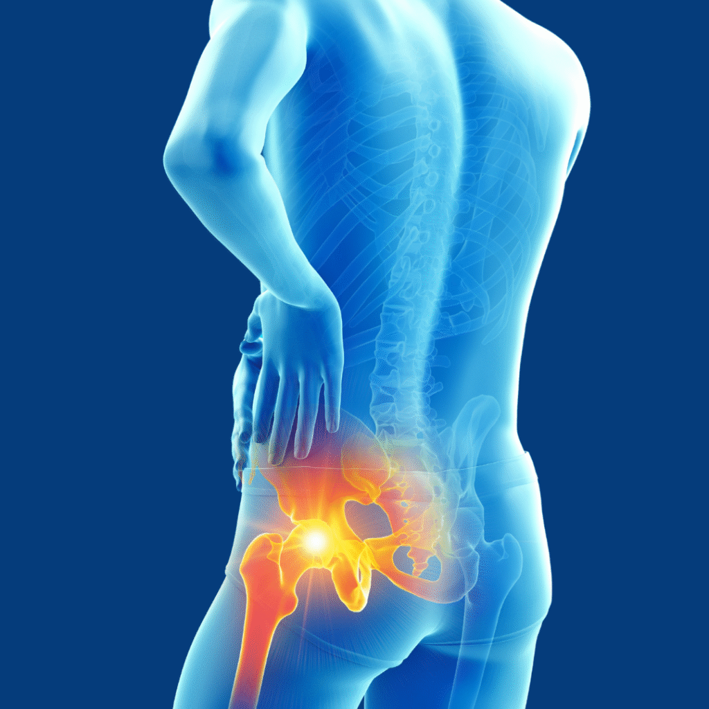 Physiotherapy and rehabilitation treatment for Avascular Necrosis to restore joint mobility and reduce hip pain.