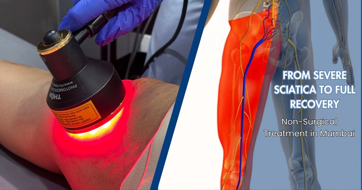 Non-Surgical Sciatica Treatment in Mumbai