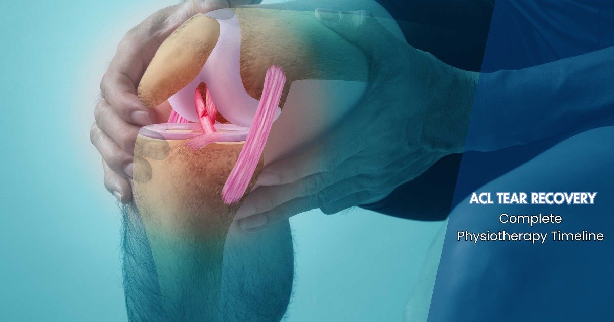 ACL Tear Recovery – Complete Physiotherapy Timeline Bandra, Mumbai