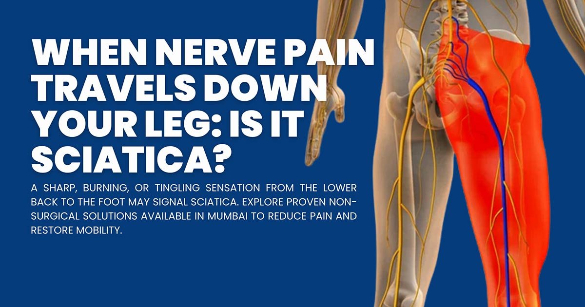 Sciatica Treatment in Mumbai